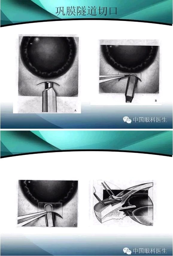 ���������������󲢷�֢��������ѧ�߱ر��ؼ���