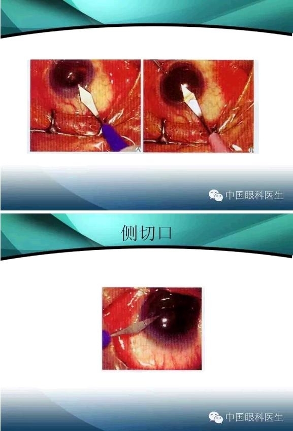 ���������������󲢷�֢��������ѧ�߱ر��ؼ���