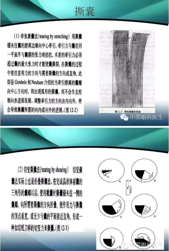 ���������������󲢷�֢��������ѧ�߱ر��ؼ���