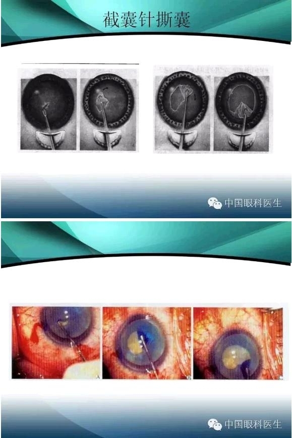 ���������������󲢷�֢��������ѧ�߱ر��ؼ���