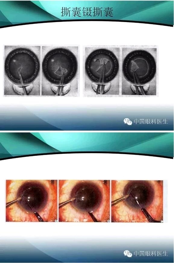 ���������������󲢷�֢��������ѧ�߱ر��ؼ���