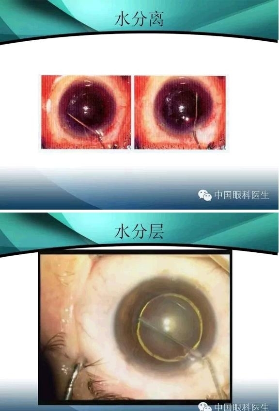 ���������������󲢷�֢��������ѧ�߱ر��ؼ���