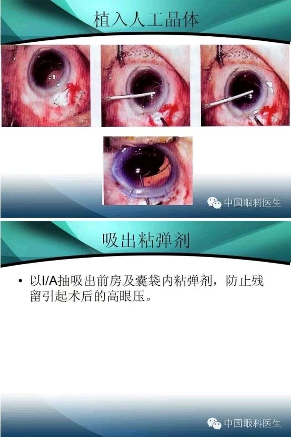 ���������������󲢷�֢��������ѧ�߱ر��ؼ���