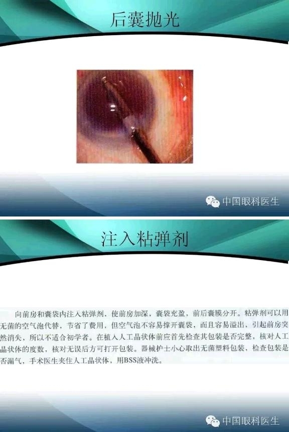 ���������������󲢷�֢��������ѧ�߱ر��ؼ���