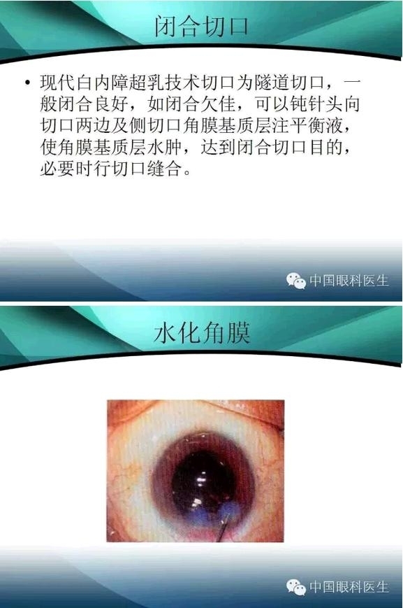 ���������������󲢷�֢��������ѧ�߱ر��ؼ���