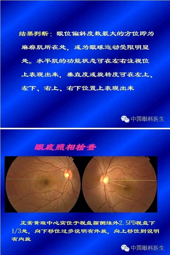 б�ӵļ���������PPT�棩