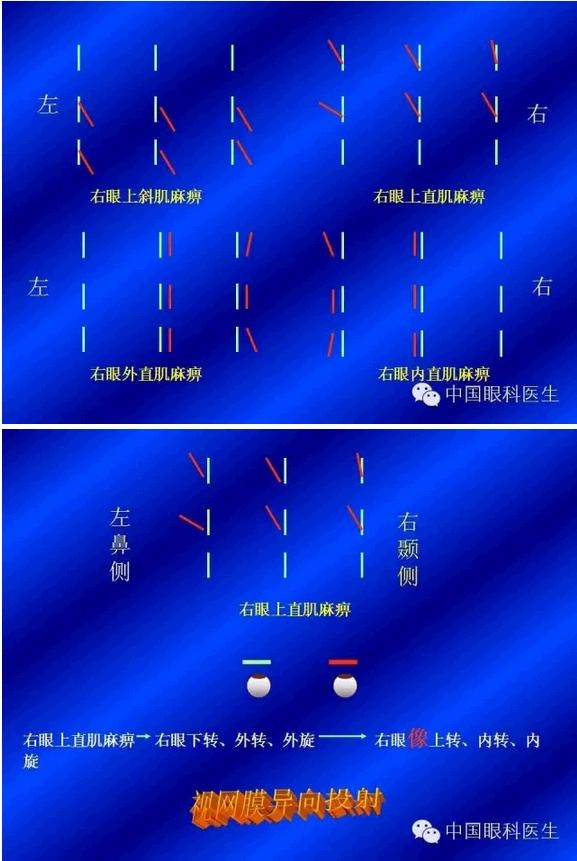 б�ӵļ���������PPT�棩