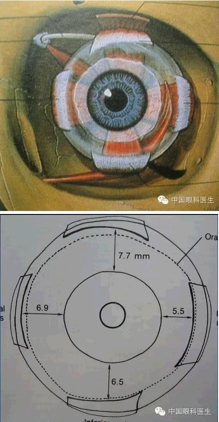 �ۿ��Ľ��ʣ���ȫ���ͼ����⣩