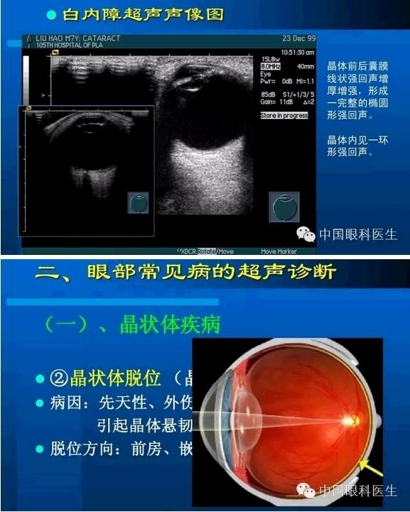 �۲��������ĳ������