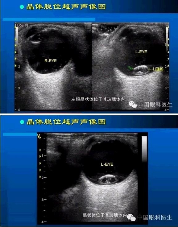 �۲��������ĳ������