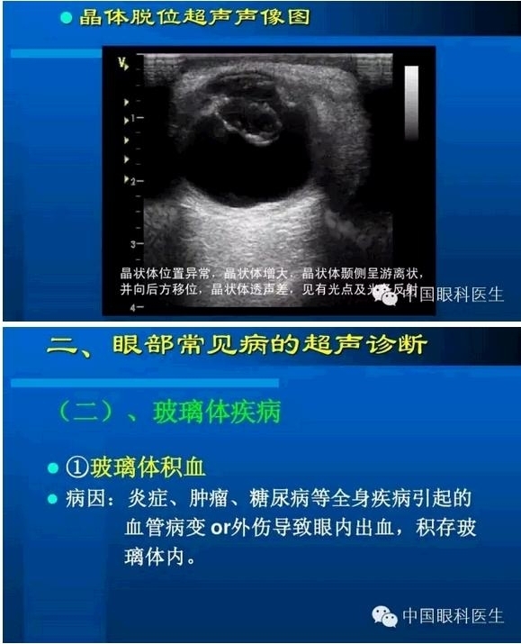 �۲��������ĳ������