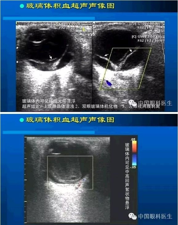 �۲��������ĳ������