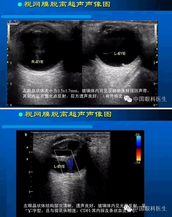 �۲��������ĳ������