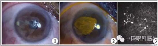 ����������Ĥ��Ƥ����������һ��