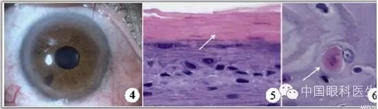 ����������Ĥ��Ƥ����������һ��