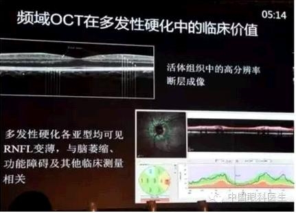 Ethan Priel���ڣ���ģʽ���������ۿ��е�Ӧ��