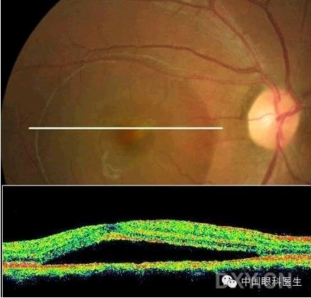 �ۿƾ���������ͬ����µ�OCT��ͼ