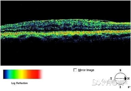 �ۿƾ���������ͬ����µ�OCT��ͼ