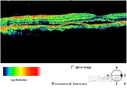 �ۿƾ���������ͬ����µ�OCT��ͼ