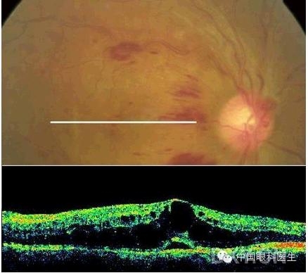 �ۿƾ���������ͬ����µ�OCT��ͼ