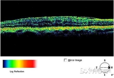 �ۿƾ���������ͬ����µ�OCT��ͼ