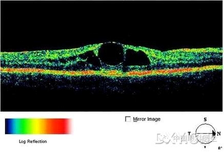 �ۿƾ���������ͬ����µ�OCT��ͼ