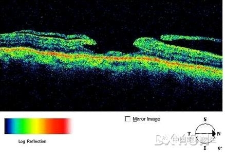 �ۿƾ���������ͬ����µ�OCT��ͼ