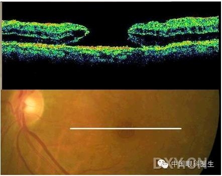 �ۿƾ���������ͬ����µ�OCT��ͼ