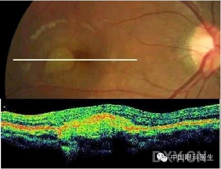 �ۿƾ���������ͬ����µ�OCT��ͼ