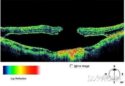 �ۿƾ���������ͬ����µ�OCT��ͼ