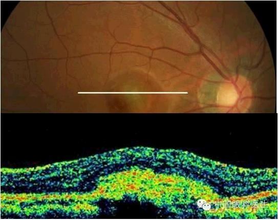 �ۿƾ���������ͬ����µ�OCT��ͼ