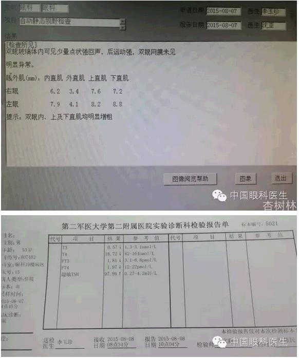 ����������״���۲��������ʹ��Ƥ����̴�����