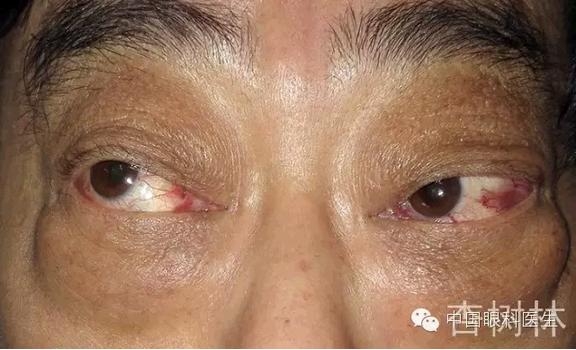 ����������״���۲��������ʹ��Ƥ����̴�����