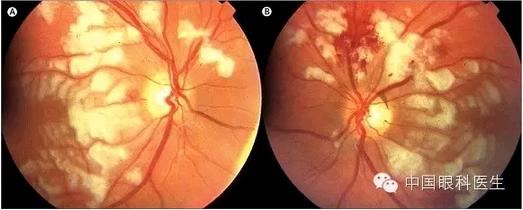 �������������������շ��ն�������ĤѪ�ܲ���һ��