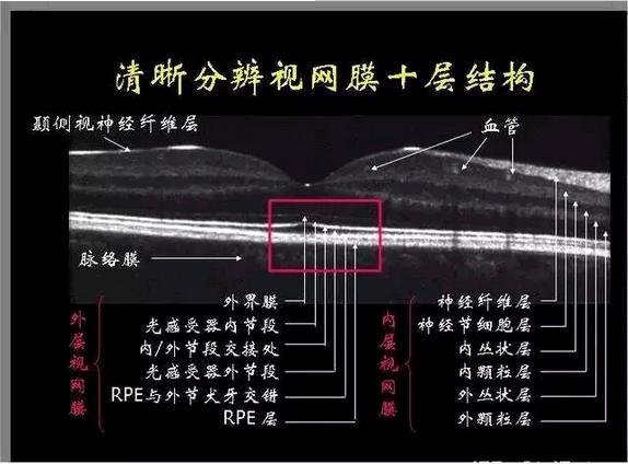 OCT����Ĥ�����Ӧ��ϵ