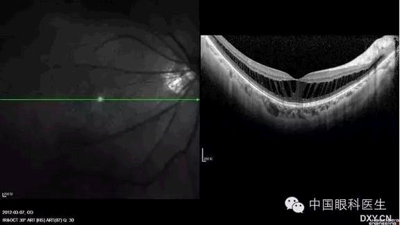 OCT����Ĥ�����Ӧ��ϵ