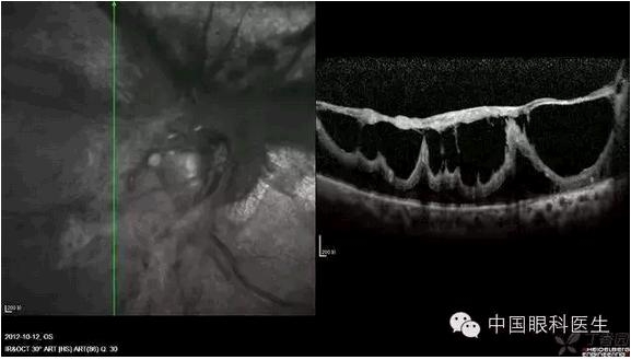 OCT����Ĥ�����Ӧ��ϵ