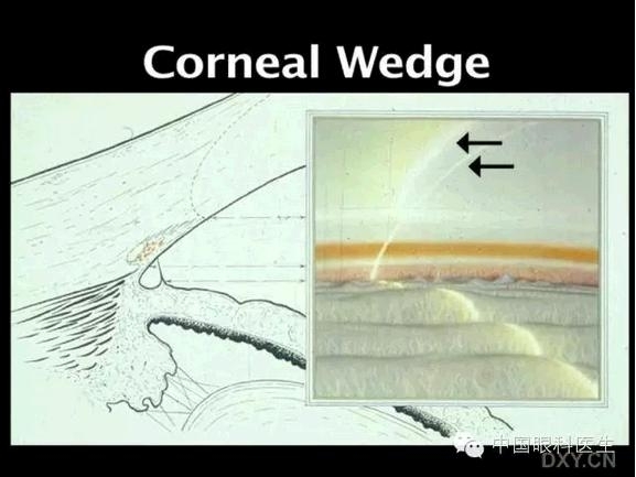 ��ͼ���䡪�����Ǿ��µĽṹ