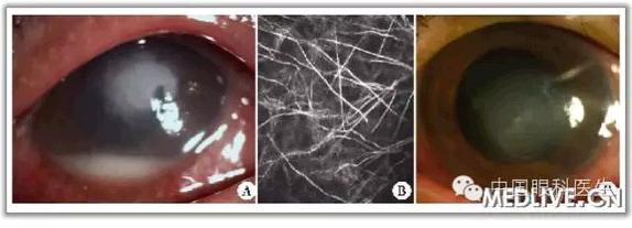 �����������干�۽���΢���������Խ�Ĥ��һ��