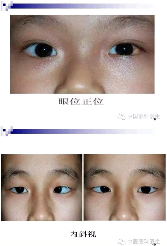 б�������ӵļ�顢��ϡ�����