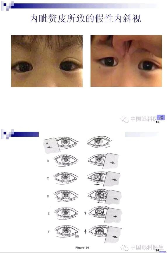 б�������ӵļ�顢��ϡ�����