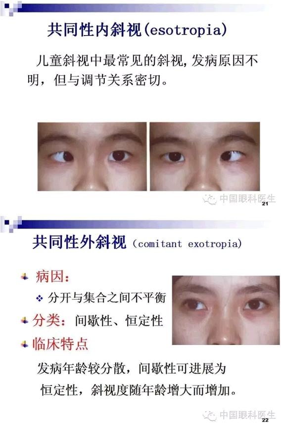 б�������ӵļ�顢��ϡ�����