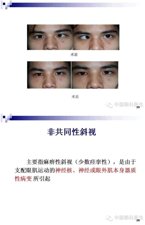 б�������ӵļ�顢��ϡ�����