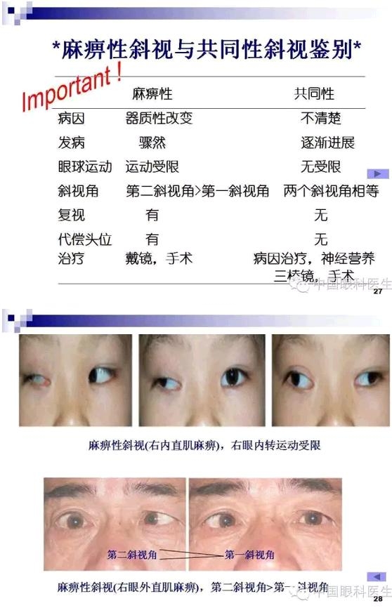 б�������ӵļ�顢��ϡ�����