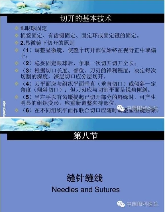 �ۿ���΢����ԭ�򼰻�����������