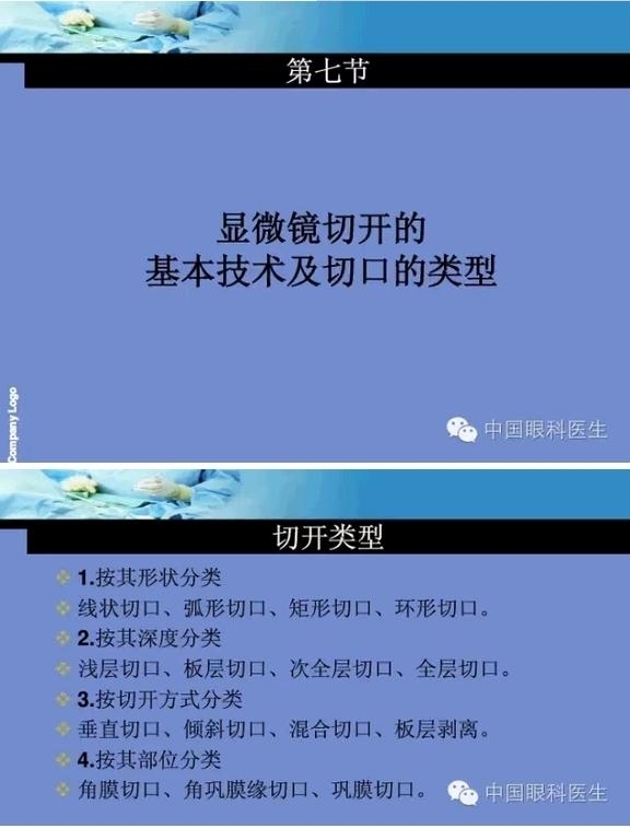 �ۿ���΢����ԭ�򼰻�����������