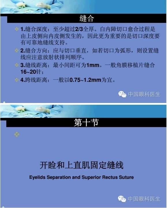 �ۿ���΢����ԭ�򼰻�����������