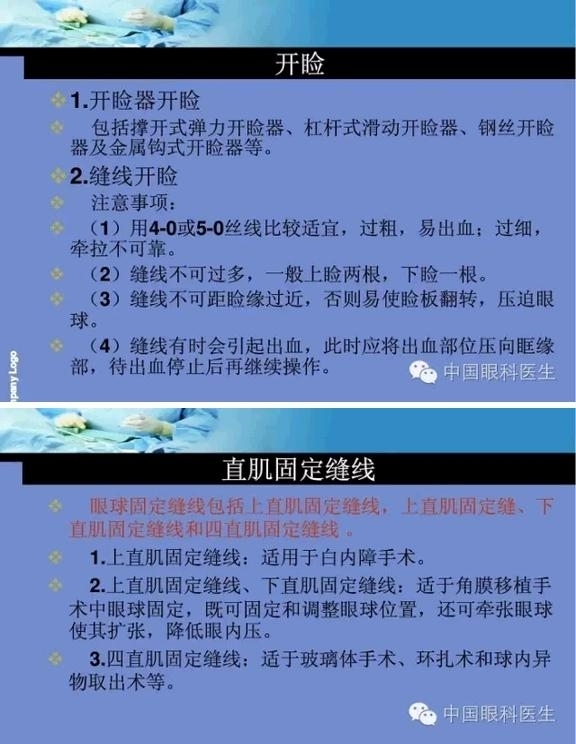 �ۿ���΢����ԭ�򼰻�����������