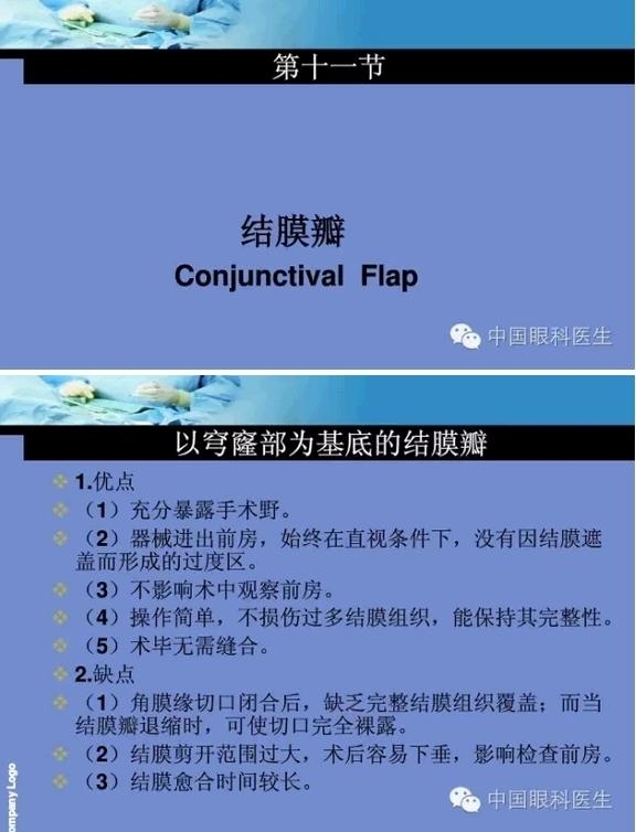 �ۿ���΢����ԭ�򼰻�����������