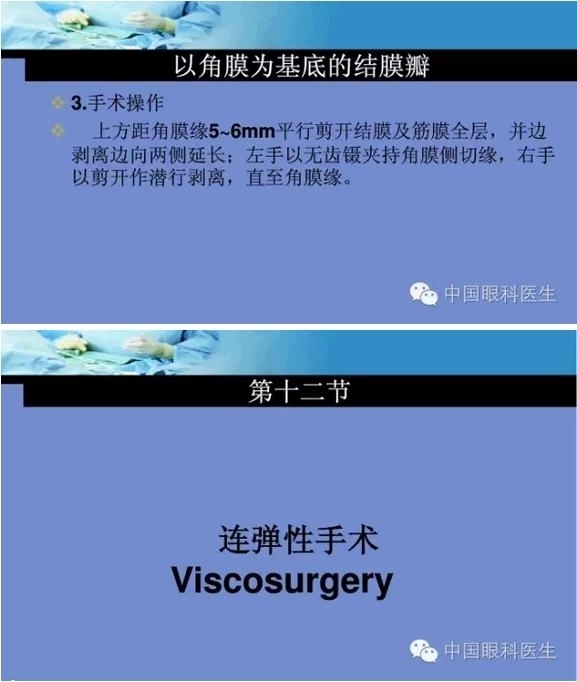 �ۿ���΢����ԭ�򼰻�����������